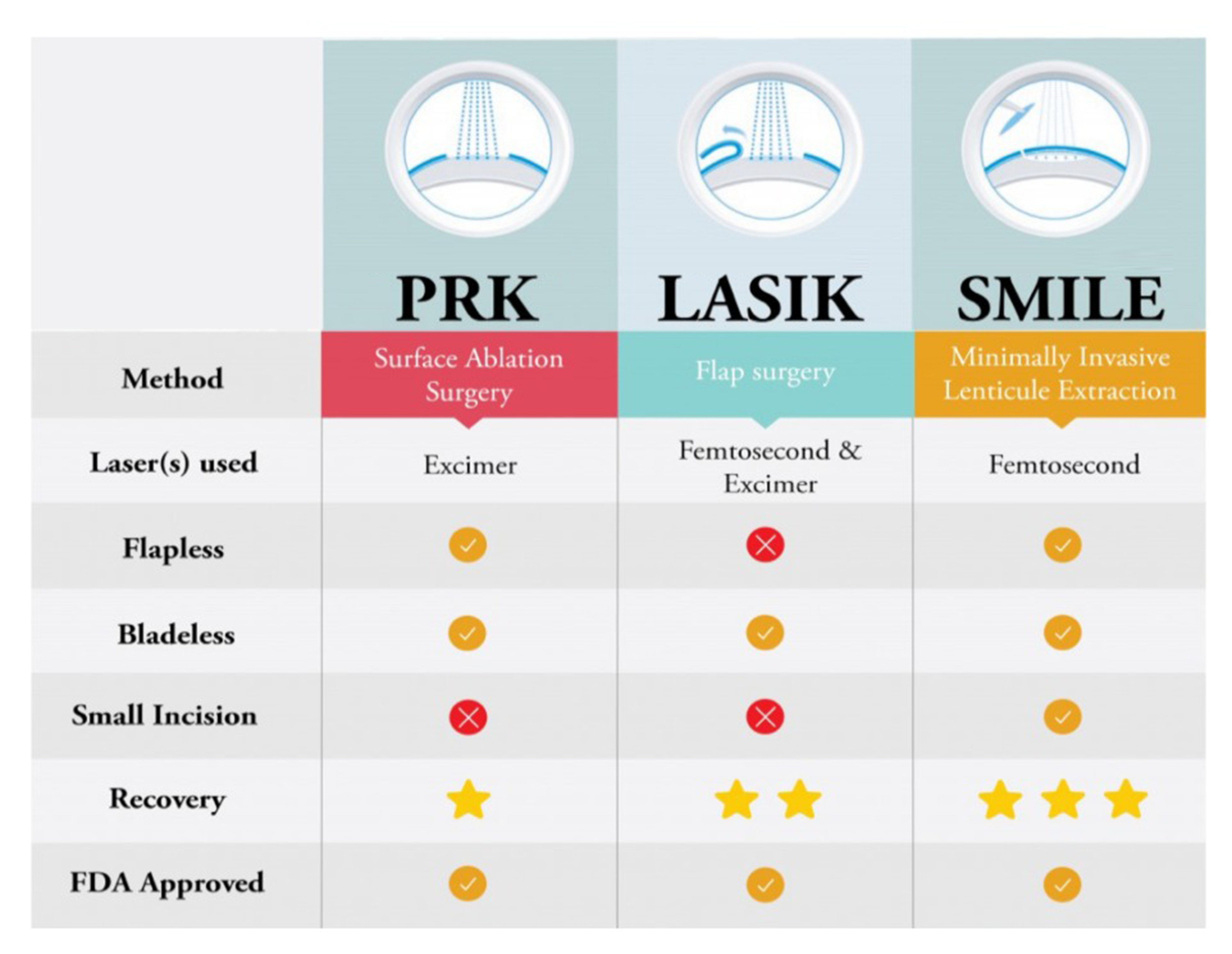 lasik surgery